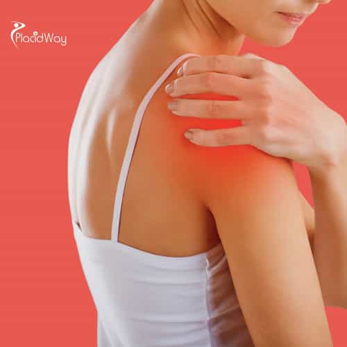 Stem Cell Therapy for Ligament Injuries in Mexico: Key Insights for Canadian Patients